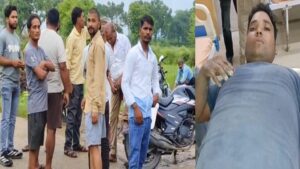 Aligarh:भौंकने पर मादा श्वान और विरोध करने पर युवक को मारी गोली, मादा श्वान की मौत, युवक गंभीर घायल – Female Dog And Young Man Shot